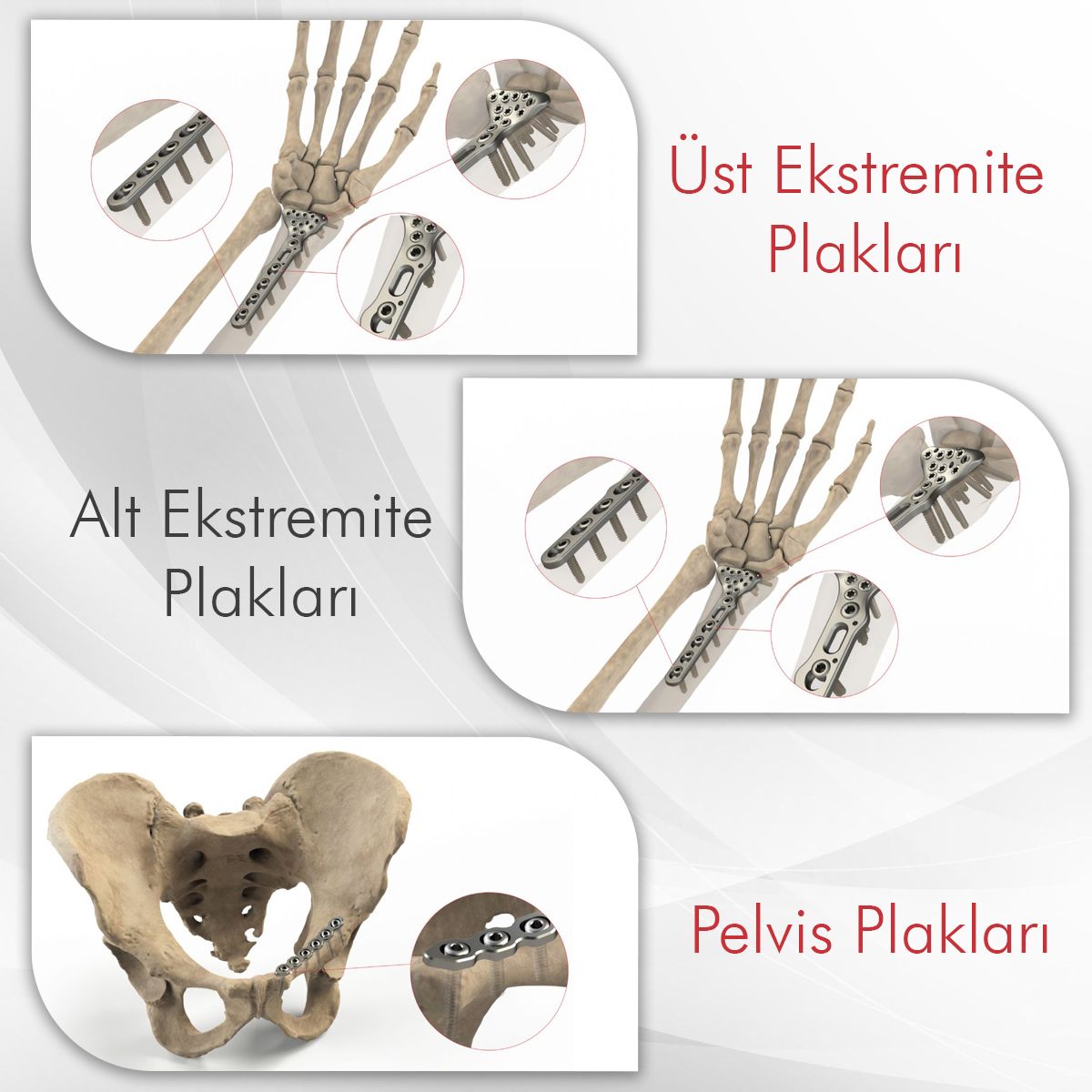 Alt �st Ekstremite